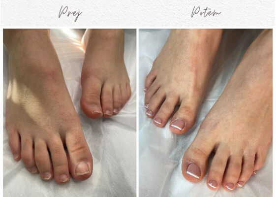 Estetska pedikura za lep videz in razvajanje vaših stopal